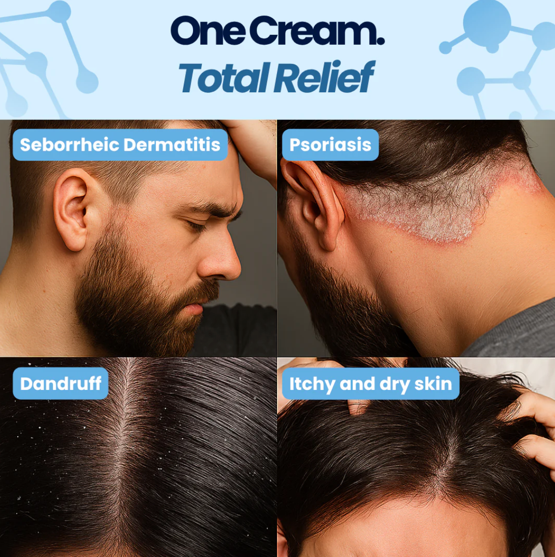 Men's Seb Derm Treatment