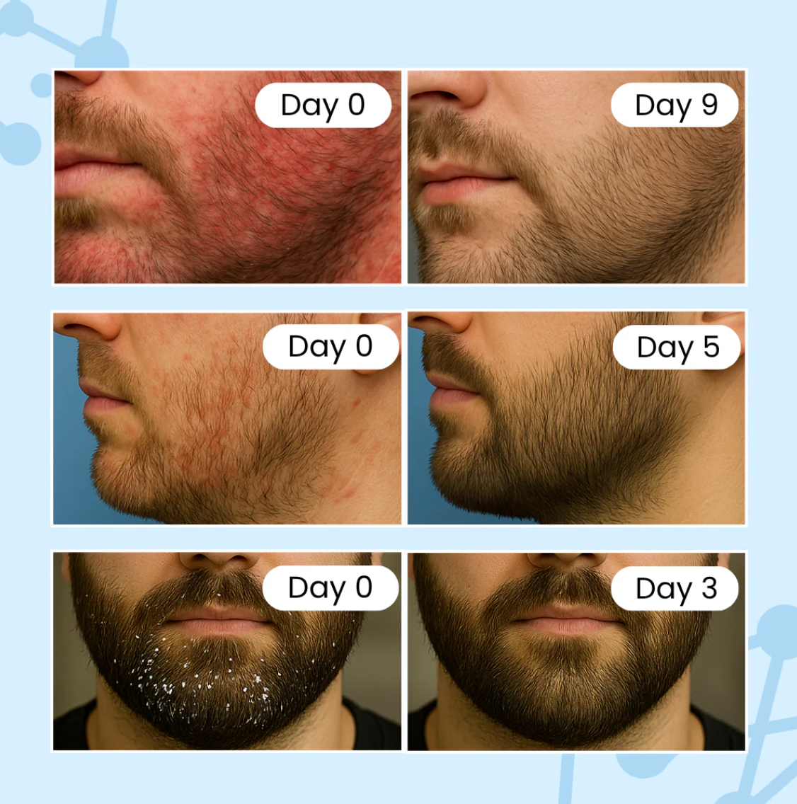 Men's Seb Derm Treatment